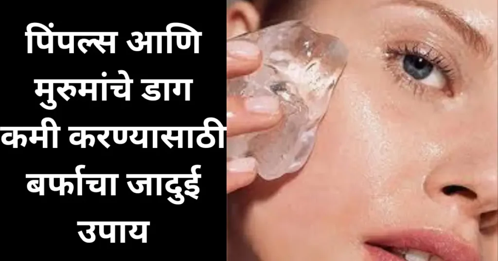 पिंपल्स आणि मुरुमांचे डाग कमी करण्यासाठी बर्फाचा जादुई उपाय!