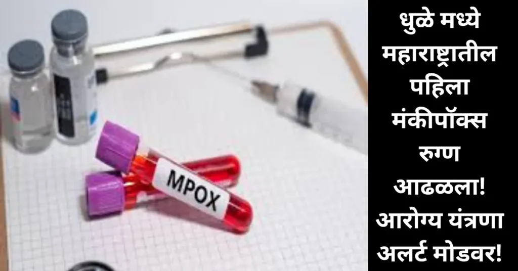 धुळे मध्ये महाराष्ट्रातील पहिला मंकीपॉक्स रुग्ण आढळला! आरोग्य यंत्रणा अलर्ट मोडवर!
