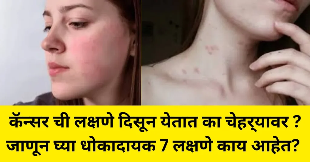 काय आहेत कॅन्सर होण्याची कारणे? चेहर्‍यातील बदल आहे का कॅन्सर चा संकेत? जाणून ही 7 धोकादायक लक्षणं!